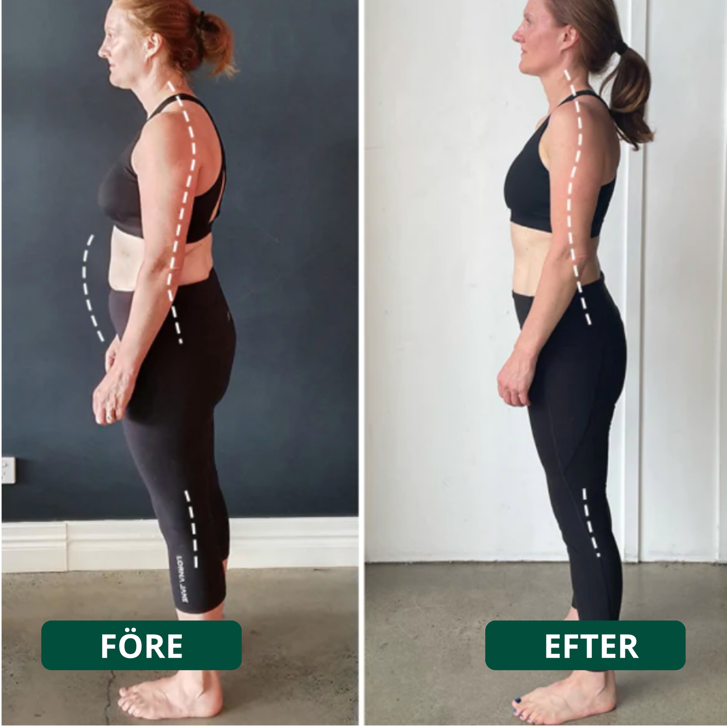 Ryggform™ – Lindrar ryggont och förbättrar hållningen