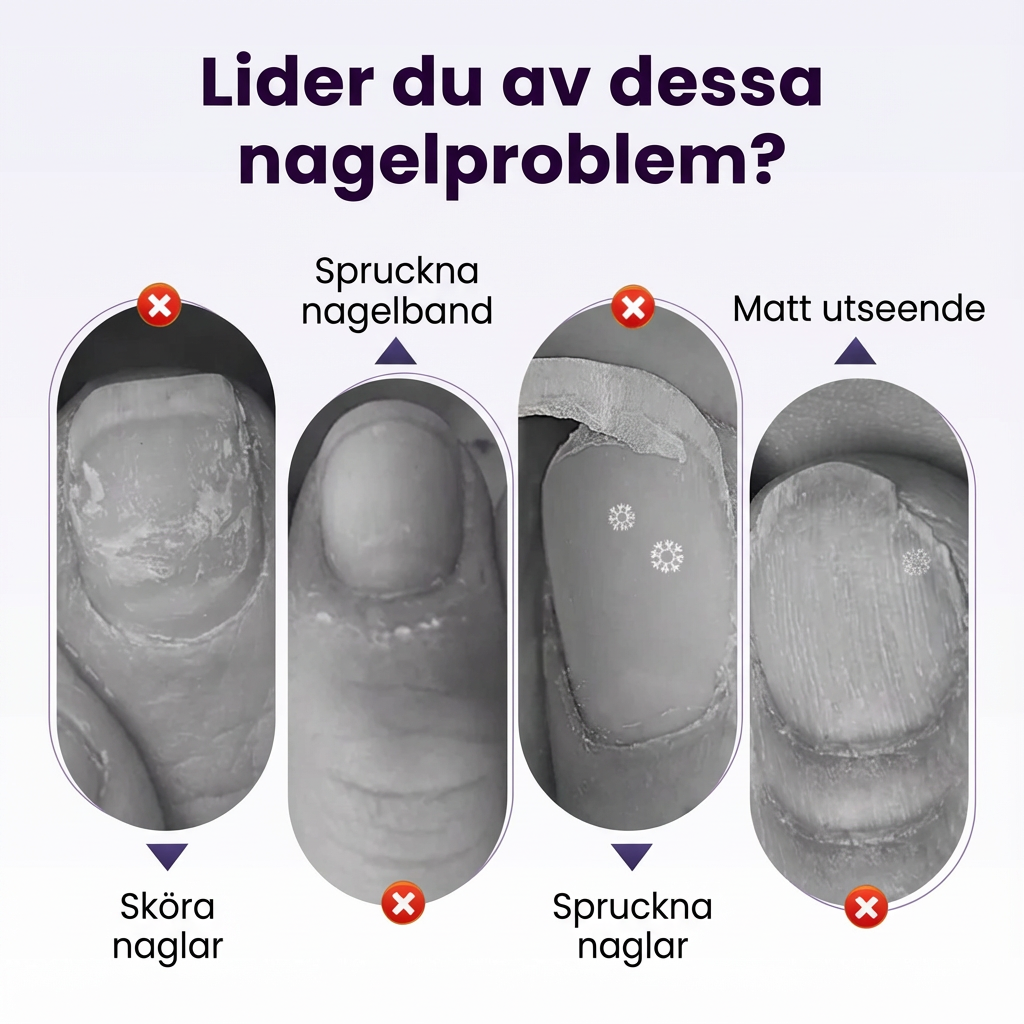 CuticleCare – 2-i-1 nagelbandspenna för mjuka och rena naglar