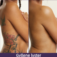 Gyllene lyster