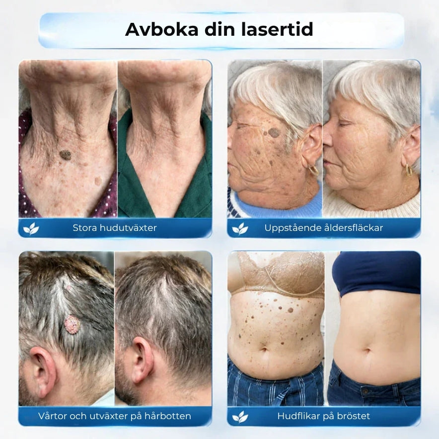 HudRoll – Exakt och kladdfri