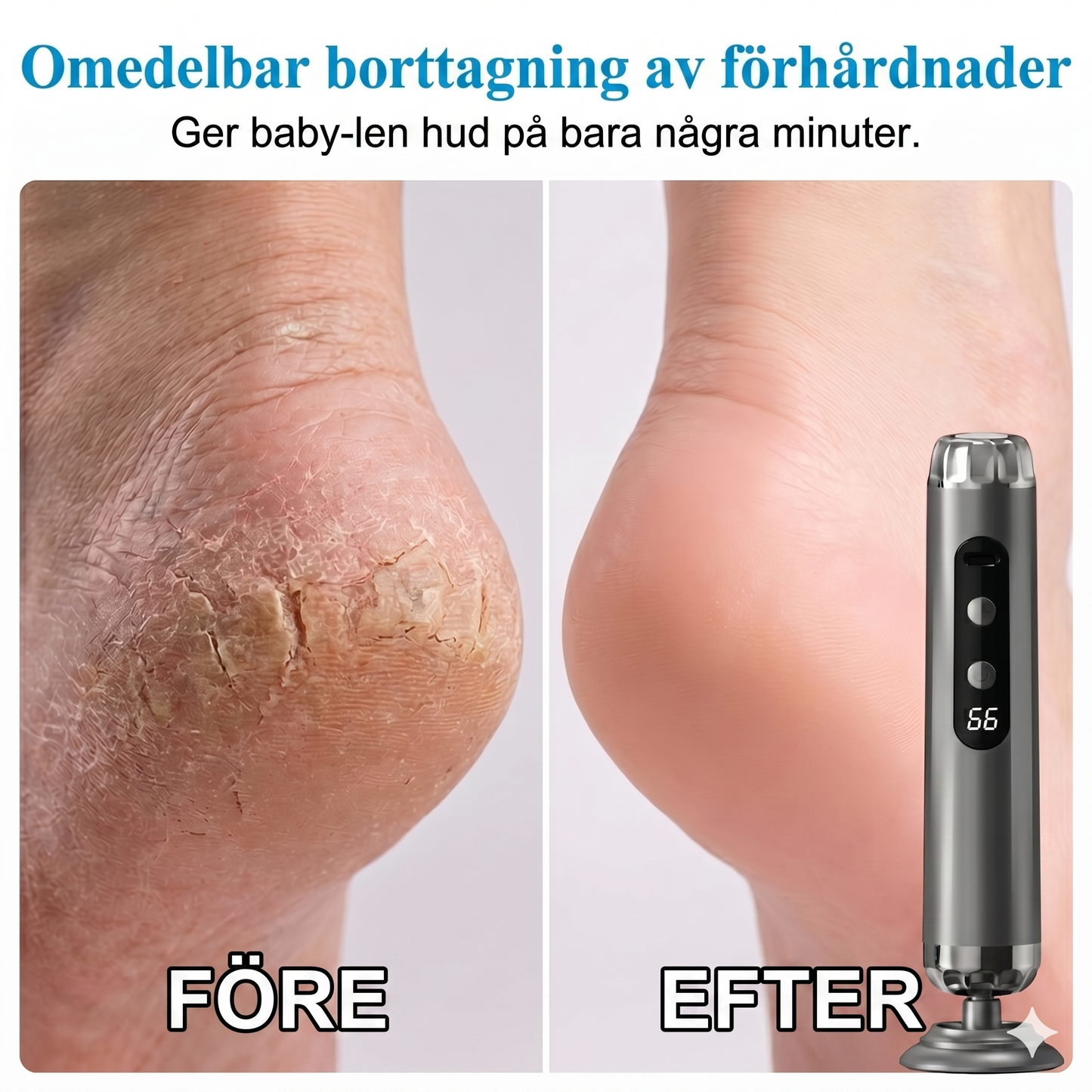 RenFil – Hygienisk och säker pedikyr