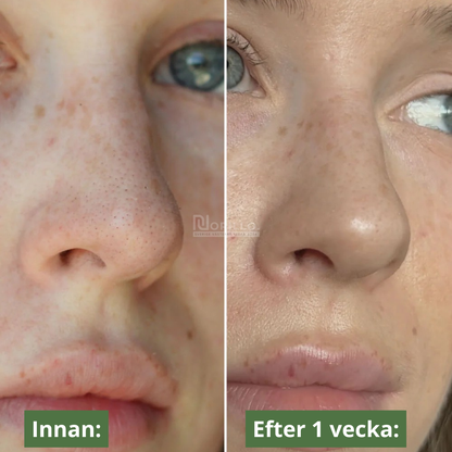DJUPVERKANDE NÄSPATCH FÖR KLARARE HUD(10 st)