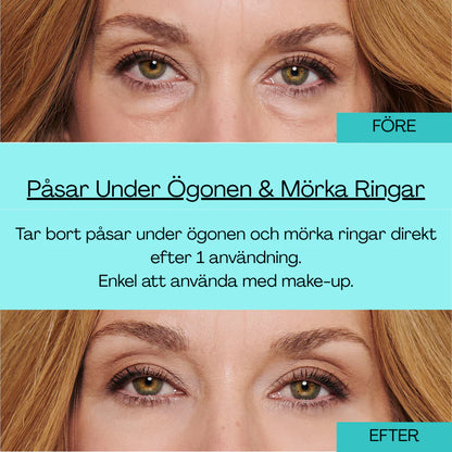 Bright™ Eliminerar ögonpäsar & rynkor